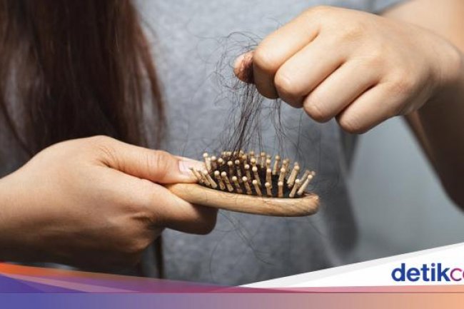 Wabah 'Rambut Rontok' Hantui India, Bikin Warganya Botak Dalam 3 Hari