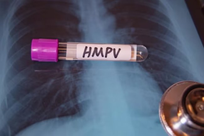 Hati-Hati! Virus HMPV Bisa Picu Pneumonia pada Bayi dan Lansia