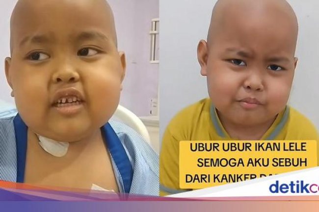 Viral Anak 6 Tahun Berjuang Lawan Kanker Darah, Harus 127 Kali Kemoterapi