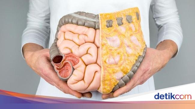 Minuman Ini Terbukti Bisa Cegah Kanker Usus Besar, Cocok Diminum di Pagi Hari