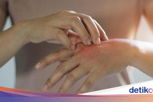 Kenapa Rasa Ingin Menggaruk Gatal Susah Dilawan? Ternyata Ada Manfaatnya