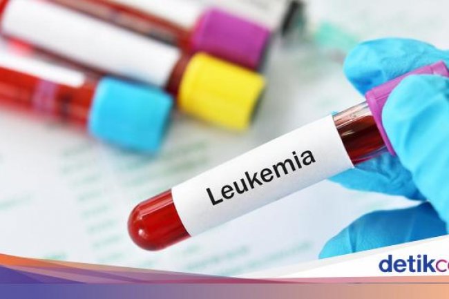 Leukemia Jadi Jenis Kanker Terbanyak pada Anak RI, IDAI Bicara Pemicunya