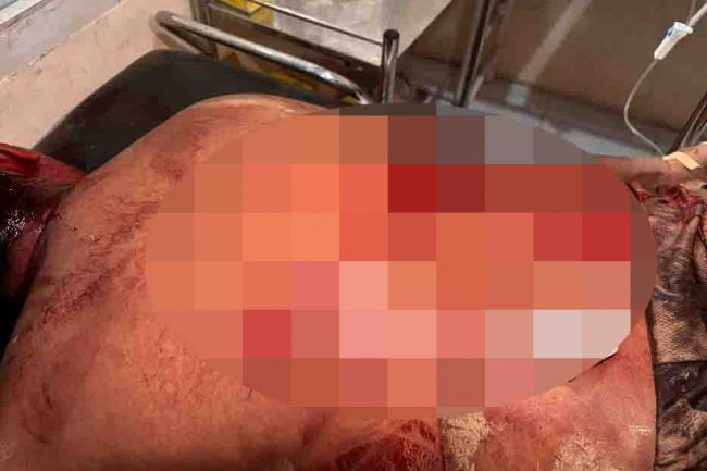 Dua Peristiwa Pembacokan di Halteng Terjadi Sepekan