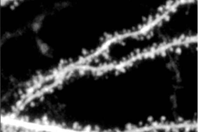 MIT Neuroscientists menemukan reseptor otak kecil yang dapat mengubah pengobatan x rapuh