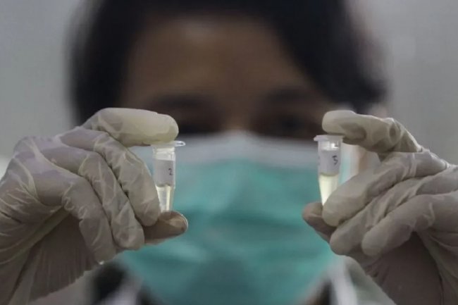 Ilmuan China Temukan Virus Corona Kelelawar Baru Serupa dengan Covid-19