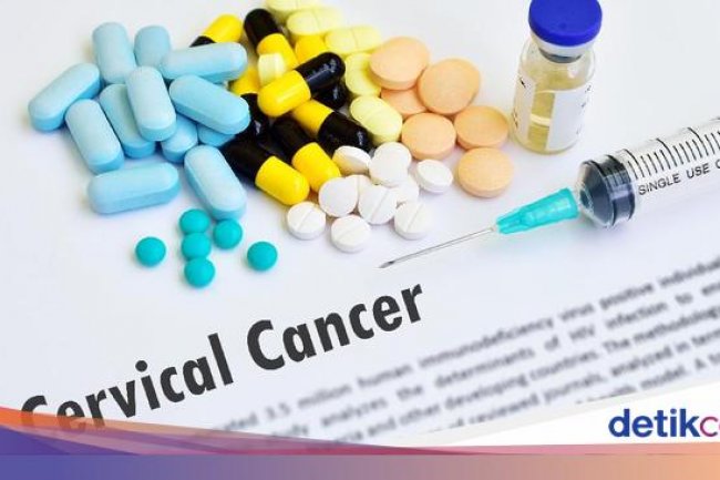 Ciri-ciri Kanker Serviks yang Tak Boleh Disepelekan, Termasuk Keputihan