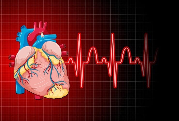 3 Fakta LAA Closure untuk Turunkan Risiko Aritmia Jantung