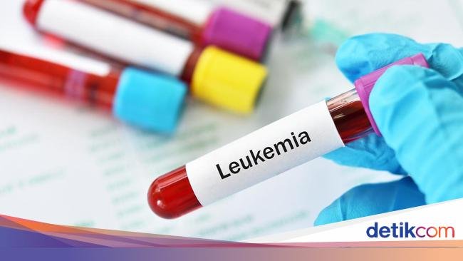 Leukemia Jadi Jenis Kanker Terbanyak pada Anak RI, IDAI Bicara Pemicunya