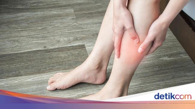 Gejala Masalah Jantung yang Muncul di Kaki, Bengkak hingga Mati Rasa