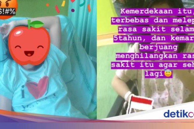 Pengakuan Wanita Jaksel Hidup Tanpa Kantong Empedu, Ini yang Dirasakan