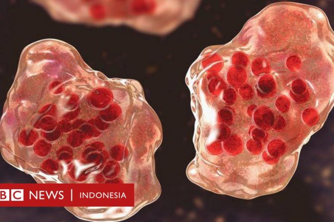 Kesehatan: Lonjakan kasus campak menghantui negara tetangga Indonesia