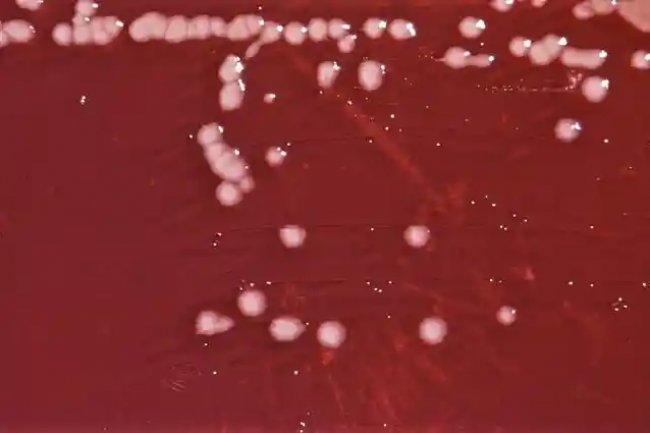 Atenuasi Alginat Liase oleh Klorheksidin dalam Jalur Alginat Pembentukan Biofilm Pseudomonas Aeruginosa - Universitas Airlangga Official Website
