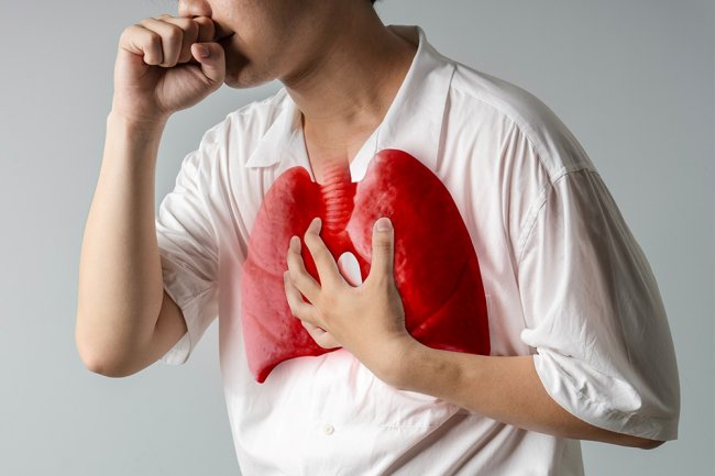 Waspada! TBC Lebih Mudah Menular Dibanding HIV/AIDS