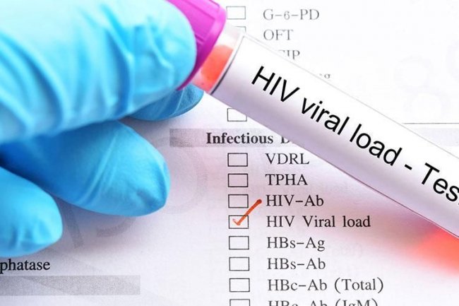 Desain Vaksin HIV yang Spesifik untuk Strain Dominan di Indonesia - Universitas Airlangga Official Website