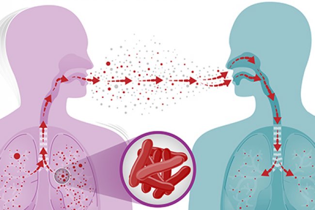 GERAKAN INDONESIA AKHIRI TUBERKULOSISdengan KOMITMEN dan AKSI NYATA (GIATKAN) - DINAS KESEHATAN PROVINSI NTB