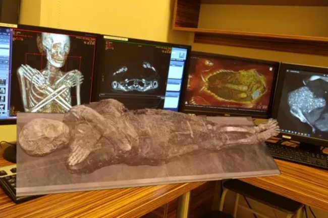 Misteri Mumi Mesir: Dugaan Kehamilan dan Kanker Terbantahkan oleh Studi Baru