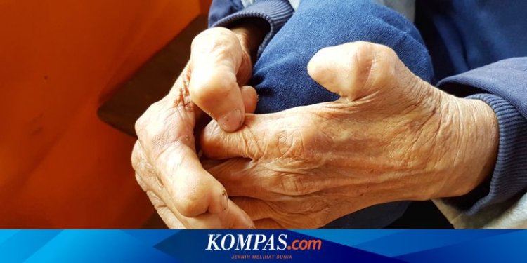 Kusta Bukan Penyakit Kutukan dan Bisa Disembuhkan