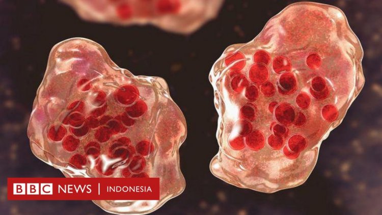 Kesehatan: Lonjakan kasus campak menghantui negara tetangga Indonesia