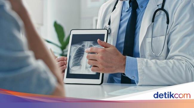 Terungkap Lewat Studi, Pola Makan Seperti Ini Bisa Picu Kanker Paru