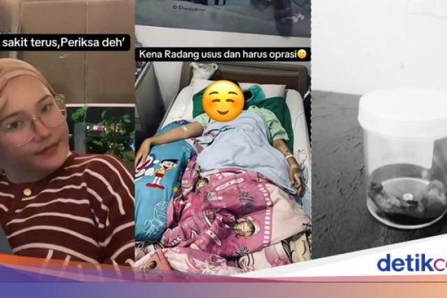 Wanita Usia 25 di Bogor Kena Radang Usus Buntu, Punya Kebiasaan Makan Ini