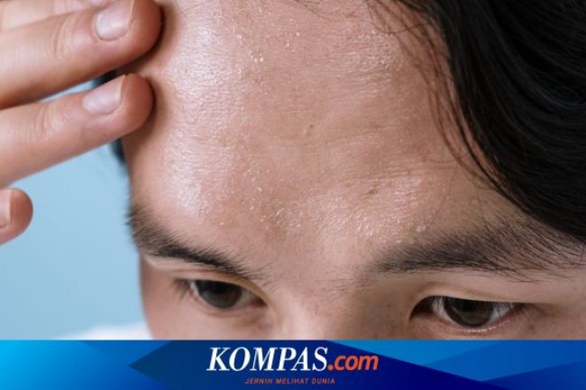 9 Cara Mengobati Keringat Berlebihan: Solusi Alami dan Medis yang Efektif