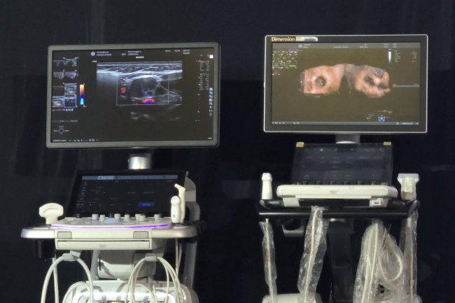 Tahap-tahap Perkembangan Penyakit Kanker Yang Harus Diwaspadai