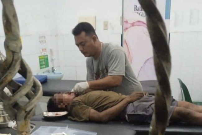 Kecelakaan Maut di Batu Bara: Pengendara Motor Tewas Tabrak Truk Berhenti