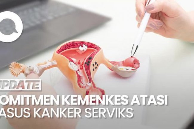 Video: Kasus Kanker Serviks di RI Capai 36 Ribu per Tahun