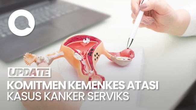 Video: Kasus Kanker Serviks di RI Capai 36 Ribu per Tahun