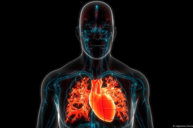 Kok Bisa Mati Gara-Gara Pakai Plastik?