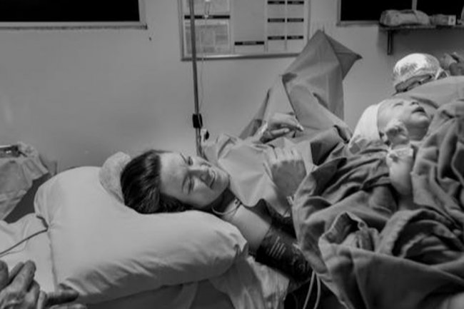 Persalinan Normal Berulang dan Potensi Peningkatan Risiko HPV