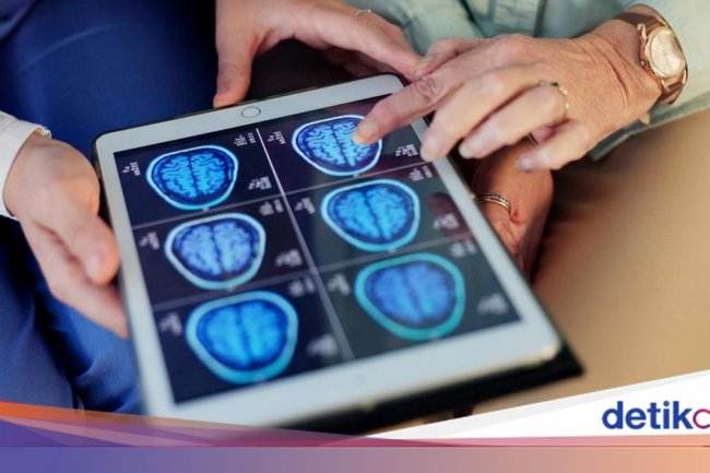 Kebiasaan Makan yang Picu Kerusakan Otak Lebih Awal di Usia Muda, Ini Gejalanya