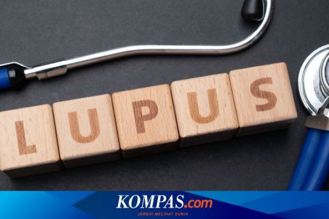 Waspadai Lupus, Penyakit “Seribu Wajah” yang Kerap Tak Disadari