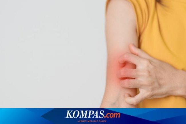4 Faktor Penyebab Lupus yang Harus Diketahui: Ada Genetik dan Lingkungan