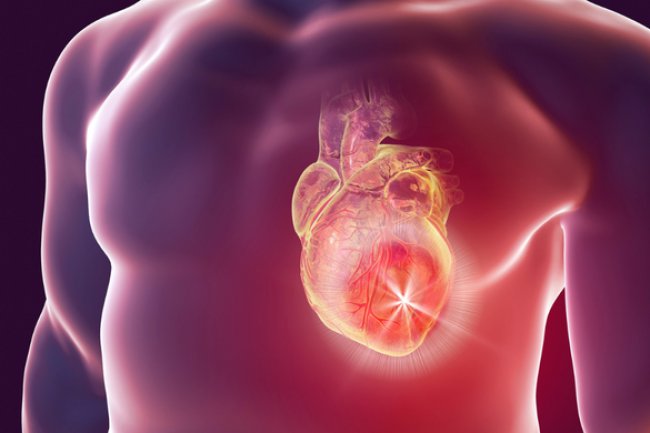 Gejala Serangan Jantung Sering Dikira Masuk Angin, Kenali Perbedaan dan Cara Penanganannya