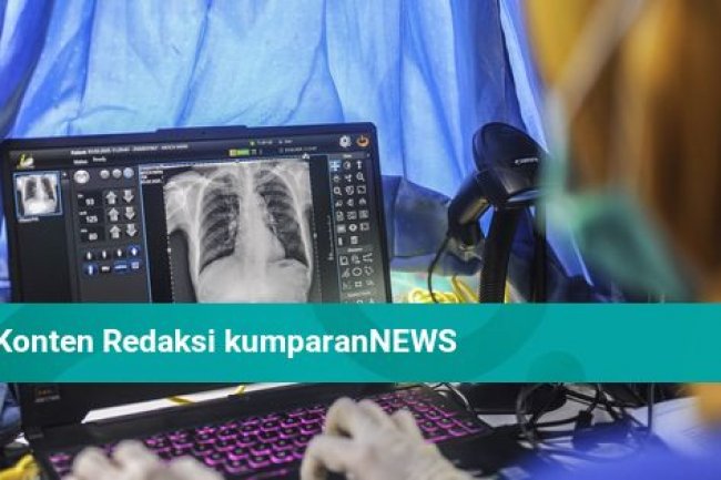 Apakah Pasien TBC Perlu Mengulang Pengobatan Jika Lupa Minum Obat?