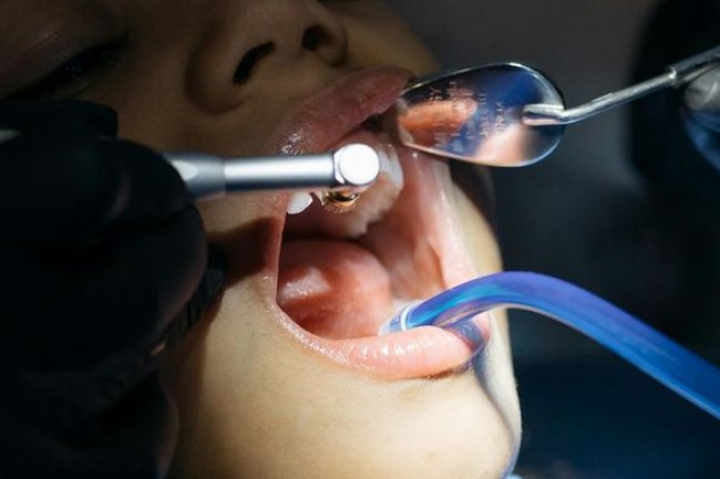 Dari Herpes hingga Kanker, Inilah Penyakit Serius yang Bisa Terdeteksi Lewat Rongga Mulut