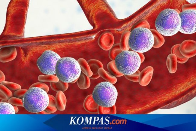 7 Tanda Kanker Darah yang Terlihat di Kulit, Apa Saja?