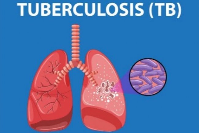 Pengaruh Iklim terhadap Penyebaran Penyakit