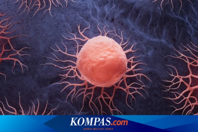 4 Kelompok yang Berisiko Terkena Kanker Tulang, Ketahui sebelum Terlambat