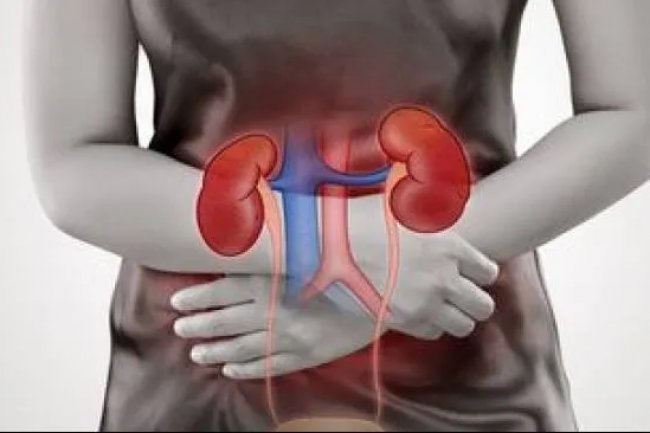 Studi Ungkap Makanan Fermentasi Dapat Cegah Penyakit Ginjal