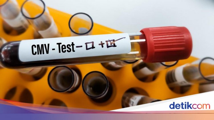 Infeksi Virus CMV Berpotensi Memperburuk Gejala Autisme