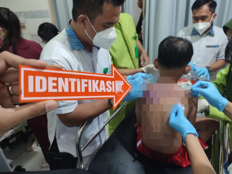 Kasus Penyiraman Air Keras kepada Ibu dan Anak Masih Misteri