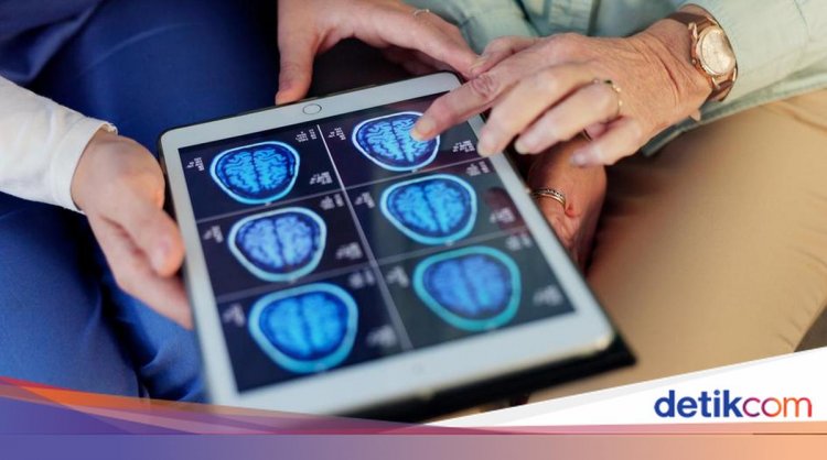 Kebiasaan Makan yang Picu Kerusakan Otak Lebih Awal di Usia Muda, Ini Gejalanya