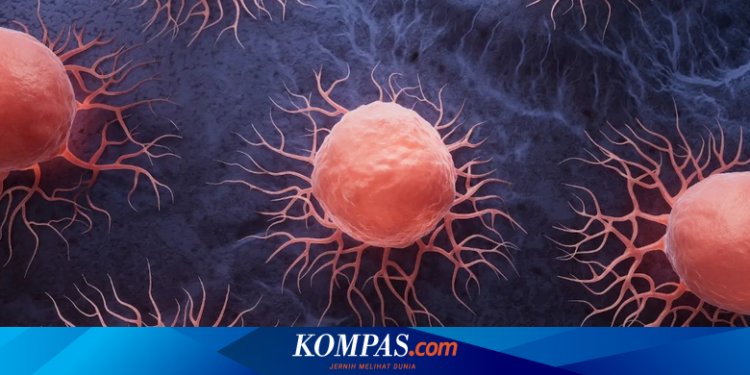 4 Kelompok yang Berisiko Terkena Kanker Tulang, Ketahui sebelum Terlambat