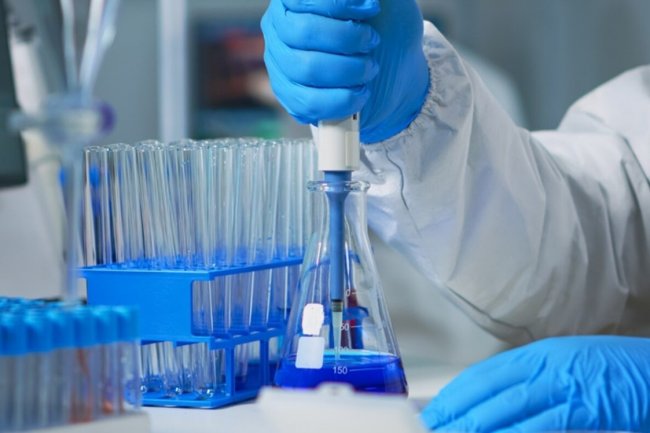 Studi Ungkap Virus Epstein-Barr Jadi Pemicu Penyakit Lupus