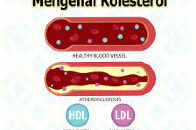 Uji Coba Terapi CRISPR-Cas9 Dapat Turunkan Kolesterol LDL pada Tubuh
