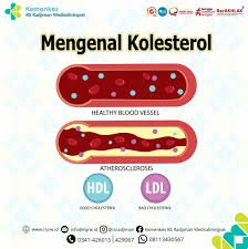 Uji Coba Terapi CRISPR-Cas9 Dapat Turunkan Kolesterol LDL pada Tubuh