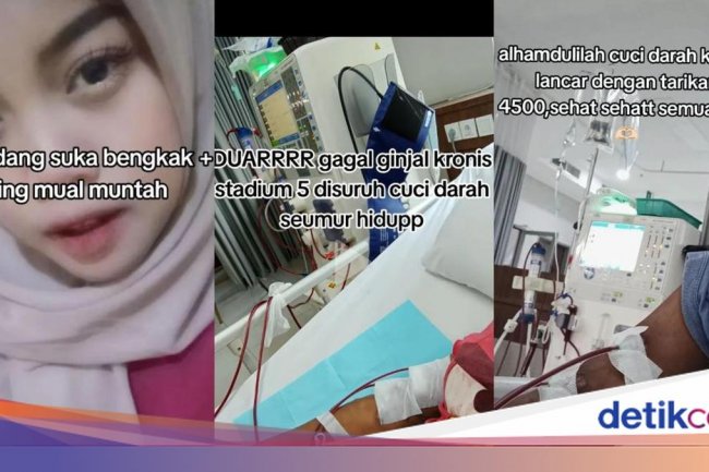 Sempat Dikira Asam Lambung, Wanita Ini Sudah 419 Kali Cuci Darah dalam 4 Tahun