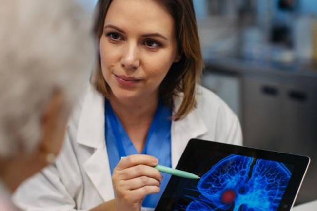 Angka Kematian Tinggi, Ini Gejala Stroke yang Harus Diwaspadai